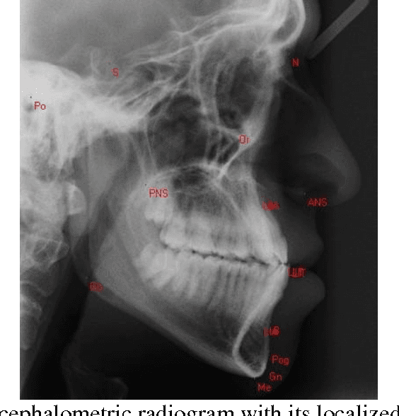 Figure 2 for A Novel Hybrid Approach for Cephalometric Landmark Detection