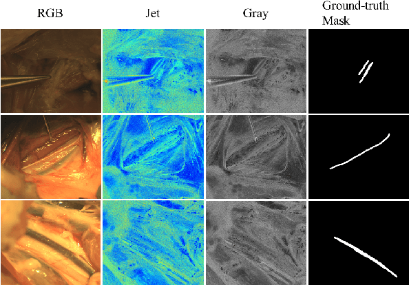 Figure 1 for DXM-TransFuse U-net: Dual Cross-Modal Transformer Fusion U-net for Automated Nerve Identification
