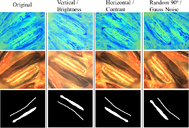 Figure 2 for DXM-TransFuse U-net: Dual Cross-Modal Transformer Fusion U-net for Automated Nerve Identification