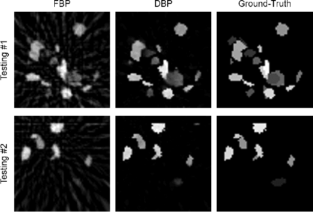 Figure 4 for Deep Back Projection for Sparse-View CT Reconstruction