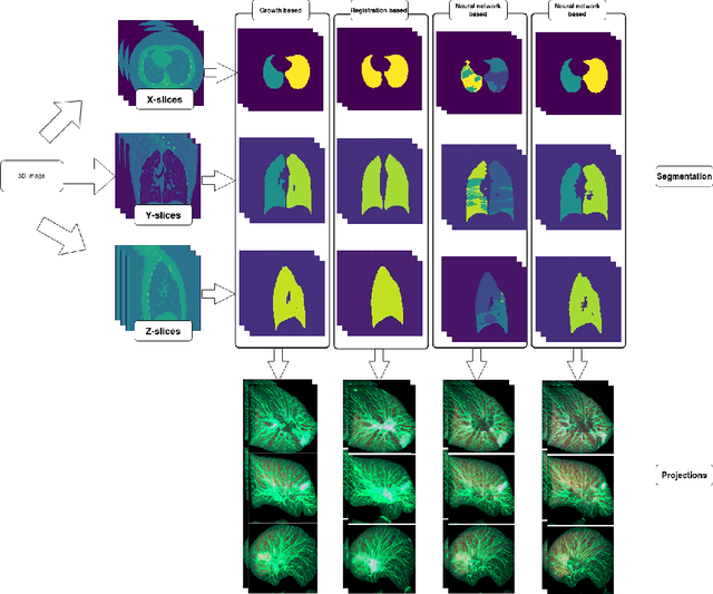 Figure 1 for Revealing Lung Affections from CTs. A Comparative Analysis of Various Deep Learning Approaches for Dealing with Volumetric Data