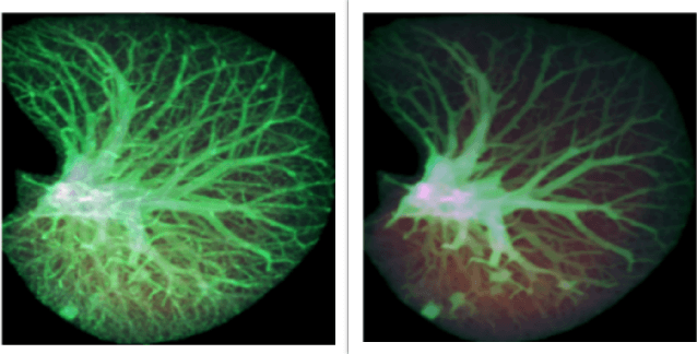 Figure 3 for Revealing Lung Affections from CTs. A Comparative Analysis of Various Deep Learning Approaches for Dealing with Volumetric Data