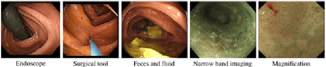 Figure 4 for Realistic Endoscopic Image Generation Method Using Virtual-to-real Image-domain Translation