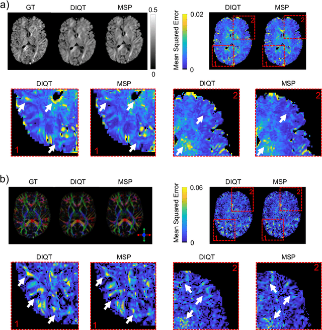 Figure 4 for Multi-Stage Prediction Networks for Data Harmonization