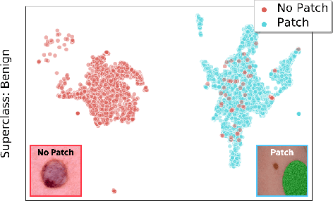 Figure 1 for No Subclass Left Behind: Fine-Grained Robustness in Coarse-Grained Classification Problems