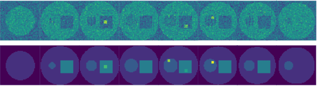 Figure 3 for Learning Hyperbolic Representations for Unsupervised 3D Segmentation