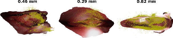Figure 3 for Reconstructing Sinus Anatomy from Endoscopic Video -- Towards a Radiation-free Approach for Quantitative Longitudinal Assessment