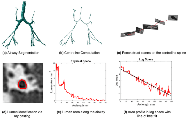 Figure 1 for Reproducibility of an airway tapering measurement in CT with application to bronchiectasis