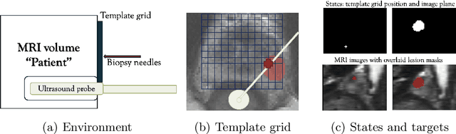 Figure 1 for Strategising template-guided needle placement for MR-targeted prostate biopsy