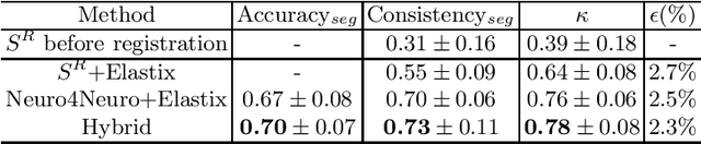 Figure 2 for A hybrid deep learning framework for integrated segmentation and registration: evaluation on longitudinal white matter tract changes