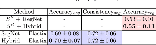 Figure 3 for A hybrid deep learning framework for integrated segmentation and registration: evaluation on longitudinal white matter tract changes