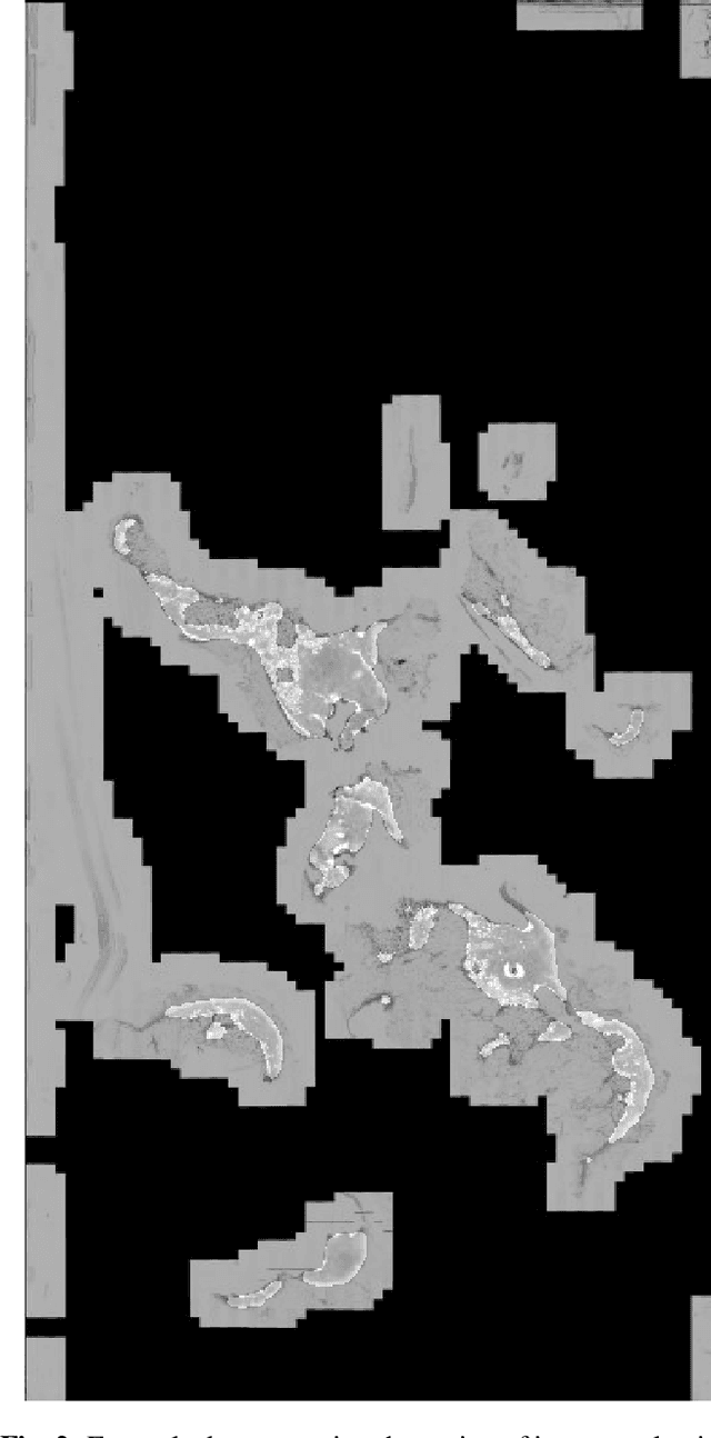 Figure 2 for Automatic breast cancer grading in lymph nodes using a deep neural network