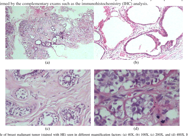 Figure 2 for Classification of histopathological breast cancer images using iterative VMD aided Zernike moments & textural signatures