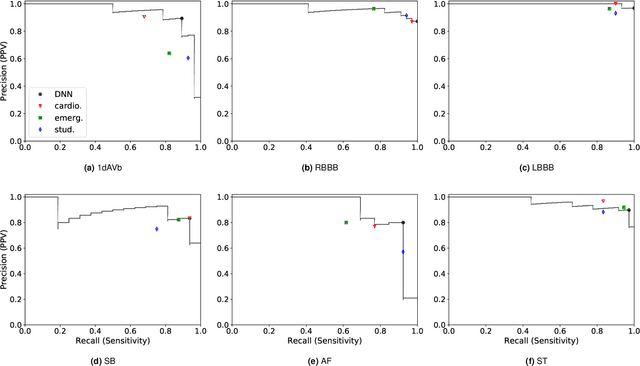 Figure 2 for Automatic Diagnosis of the Short-Duration 12-Lead ECG using a Deep Neural Network: the CODE Study