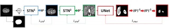 Figure 3 for Automatic size and pose homogenization with spatial transformer network to improve and accelerate pediatric segmentation