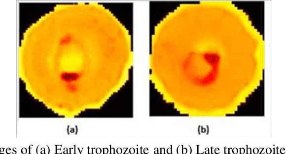 Figure 1 for Deep learning enabled multi-wavelength spatial coherence microscope for the classification of malaria-infected stages with limited labelled data size