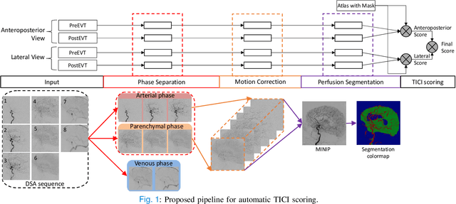 Figure 1 for autoTICI: Automatic Brain Tissue Reperfusion Scoring on 2D DSA Images of Acute Ischemic Stroke Patients
