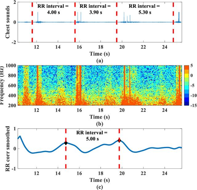 Figure 2 for Remote Monitoring of Patient Respiration with Mask Attachment -- A Pragmatic Solution for Medical Facilities