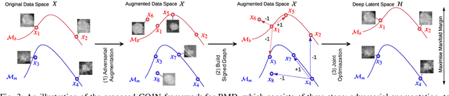 Figure 3 for COIN: Contrastive Identifier Network for Breast Mass Diagnosis in Mammography