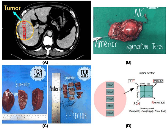 Figure 2 for Multi-Phase Cross-modal Learning for Noninvasive Gene Mutation Prediction in Hepatocellular Carcinoma