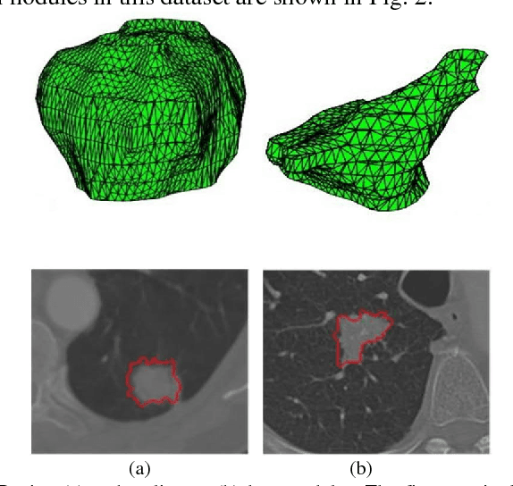 Figure 4 for Automatic multi-objective based feature selection for classification