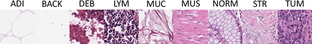 Figure 2 for Teacher-Student chain for efficient semi-supervised histology image classification