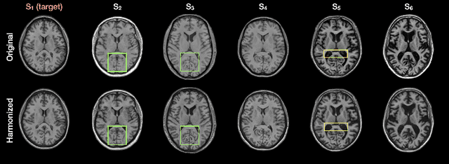 Figure 3 for Disentangling A Single MR Modality