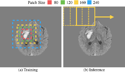 Figure 3 for PatchFCN for Intracranial Hemorrhage Detection