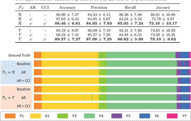 Figure 4 for ARST: Auto-Regressive Surgical Transformer for Phase Recognition from Laparoscopic Videos