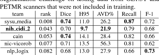 Figure 4 for White matter hyperintensity segmentation from T1 and FLAIR images using fully convolutional neural networks enhanced with residual connections