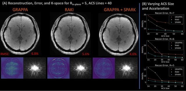 Figure 3 for Scan Specific Artifact Reduction in K-space Neural Networks Synergize with Physics-based Reconstruction to Accelerate MRI