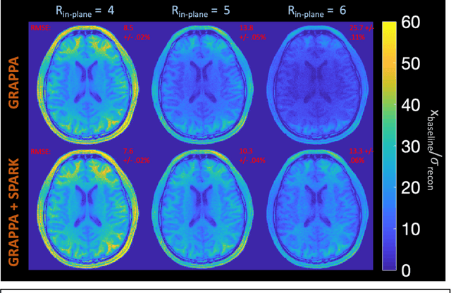Figure 4 for Scan Specific Artifact Reduction in K-space Neural Networks Synergize with Physics-based Reconstruction to Accelerate MRI