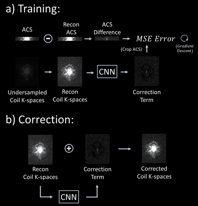 Figure 1 for Scan Specific Artifact Reduction in K-space Neural Networks Synergize with Physics-based Reconstruction to Accelerate MRI