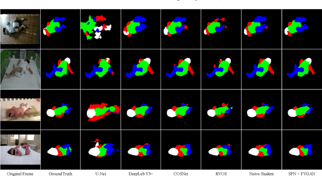 Figure 3 for Semi-supervised Body Parsing and Pose Estimation for Enhancing Infant General Movement Assessment
