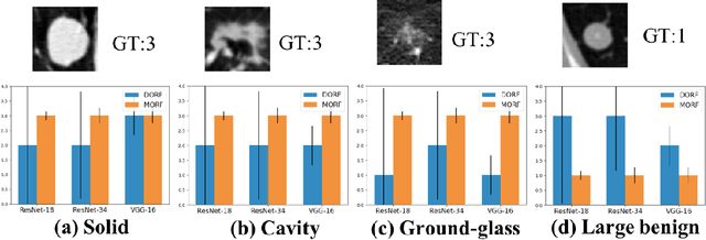 Figure 3 for Meta Ordinal Regression Forest For Learning with Unsure Lung Nodules