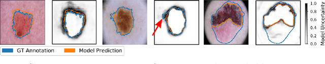 Figure 1 for Is segmentation uncertainty useful?