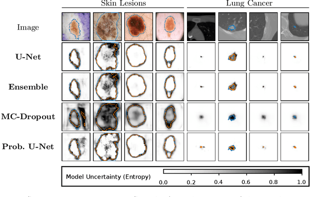 Figure 3 for Is segmentation uncertainty useful?