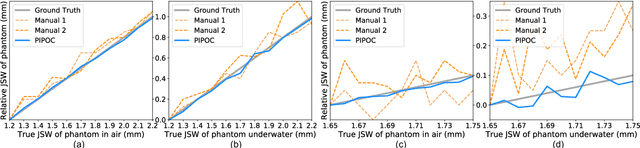 Figure 2 for A Sub-pixel Accurate Quantification of Joint Space Narrowing Progression in Rheumatoid Arthritis
