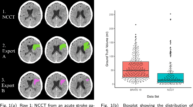 Figure 1 for Evaluation of Medical Image Segmentation Models for Uncertain, Small or Empty Reference Annotations