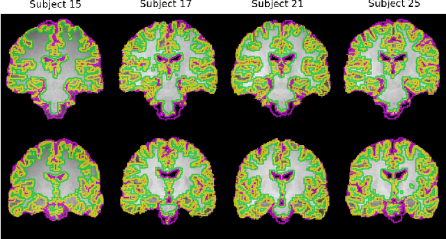 Figure 2 for DiffeoRaptor: Diffeomorphic Inter-modal Image Registration using RaPTOR