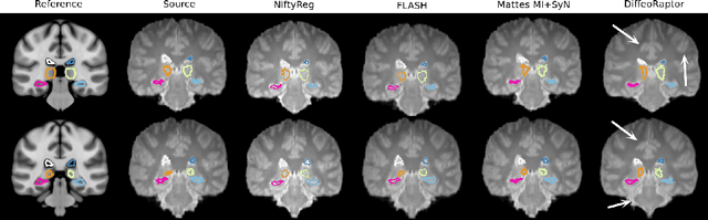 Figure 4 for DiffeoRaptor: Diffeomorphic Inter-modal Image Registration using RaPTOR