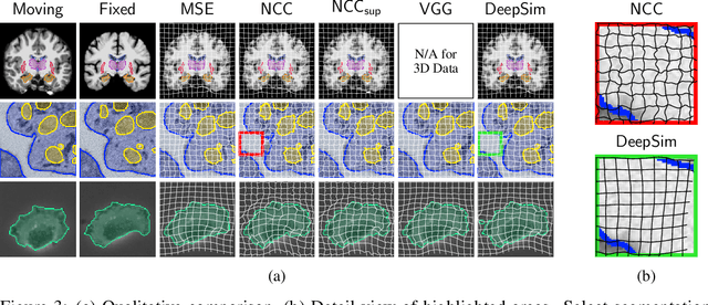 Figure 3 for DeepSim: Semantic similarity metrics for learned image registration
