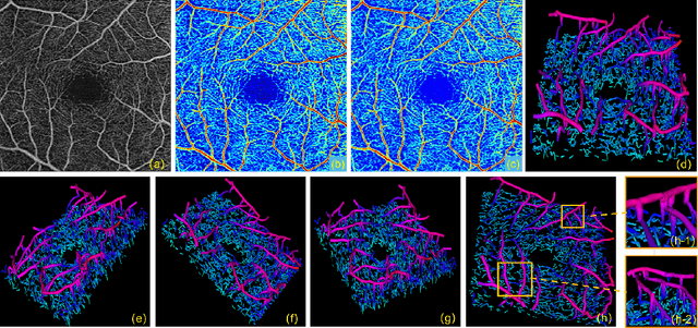 Figure 4 for 3D Vessel Reconstruction in OCT-Angiography via Depth Map Estimation