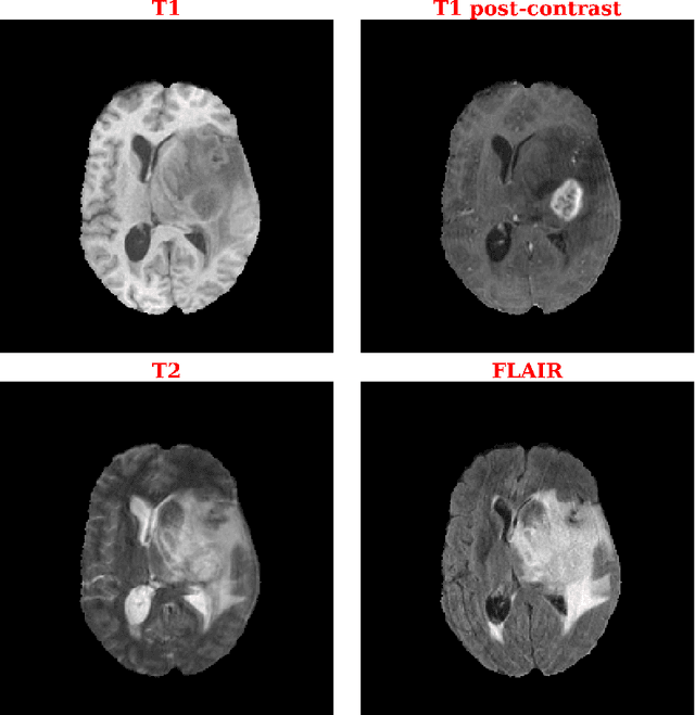 Figure 1 for Deep Neuroevolution Squeezes More out of Small Neural Networks and Small Training Sets: Sample Application to MRI Brain Sequence Classification