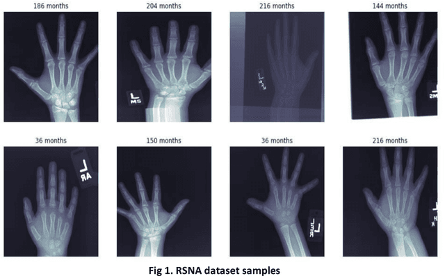Figure 1 for Pediatric Bone Age Assessment using Deep Learning Models