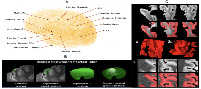 Figure 1 for Gray Matter Segmentation in Ultra High Resolution 7 Tesla ex vivo T2w MRI of Human Brain Hemispheres