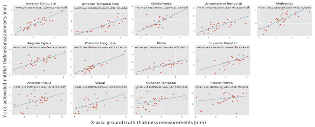 Figure 4 for Gray Matter Segmentation in Ultra High Resolution 7 Tesla ex vivo T2w MRI of Human Brain Hemispheres