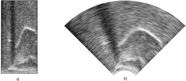 Figure 3 for 3D Convolutional Neural Networks for Ultrasound-Based Silent Speech Interfaces