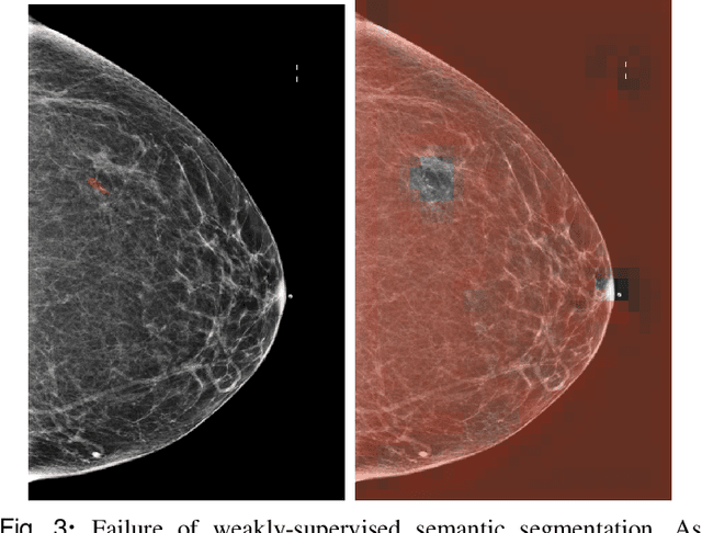 Figure 3 for 3D-GMIC: an efficient deep neural network to find small objects in large 3D images