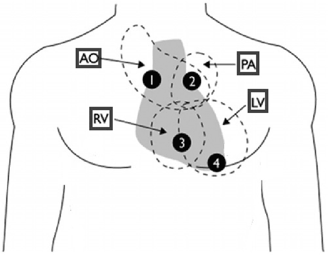 Figure 1 for The CirCor DigiScope Dataset: From Murmur Detection to Murmur Classification
